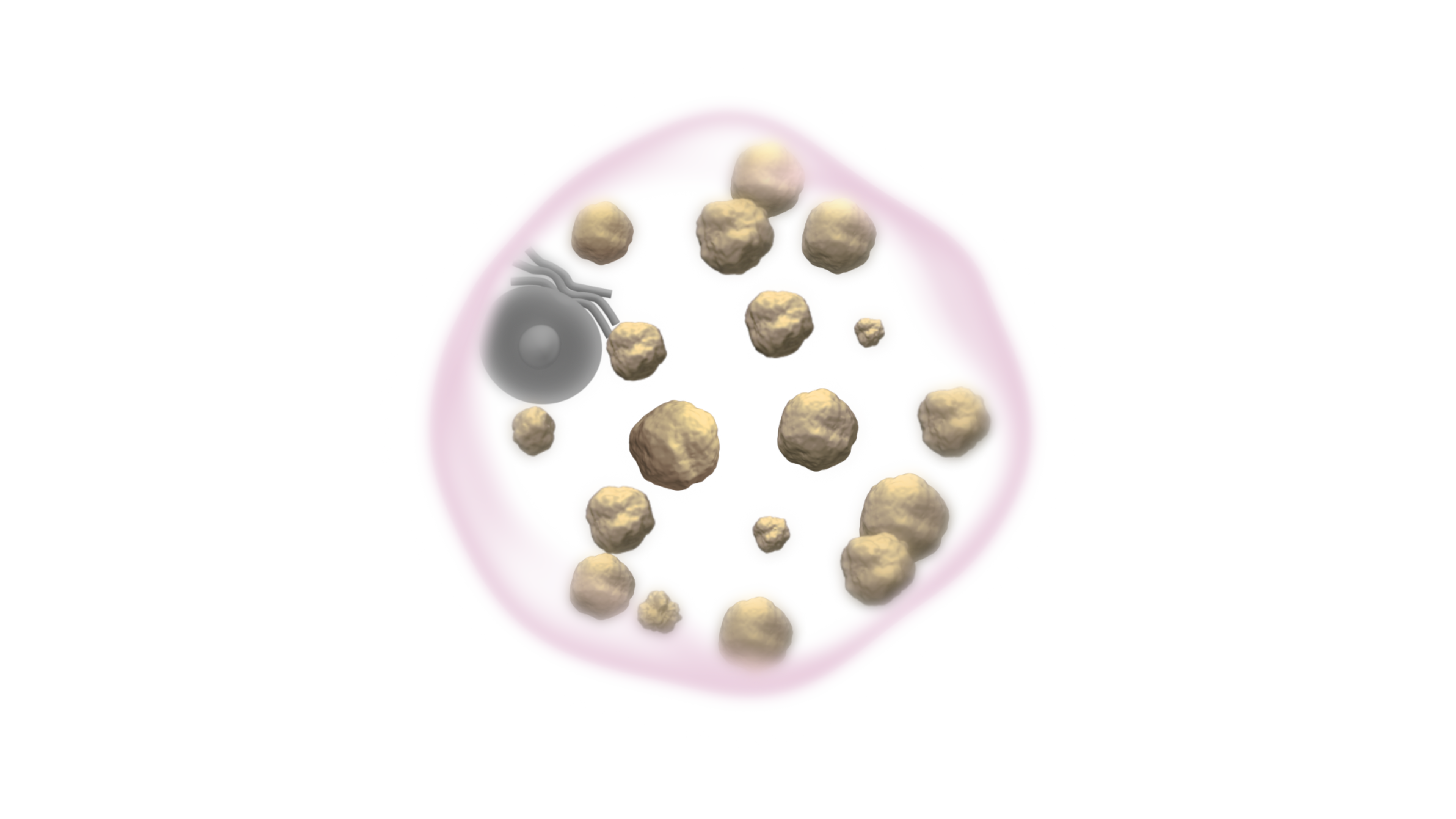 Gaucher Cell